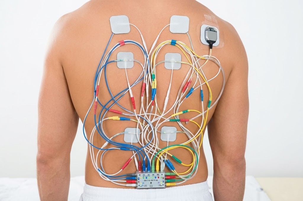 Spinal Cord Stimulation Treatment